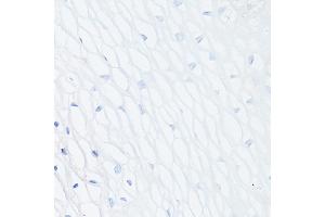 Immunohistochemistry of paraffin-embedded Human normal uterus (negative control sample) using MUC1 Rabbit mAb (ABIN7268687) at dilution of 1:100 (40x lens).