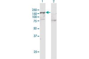 Image no. 1 for anti-SWI/SNF Related, Matrix Associated, Actin Dependent Regulator of Chromatin, Subfamily A, Member 5 (SMARCA5) (AA 1-1052) antibody (ABIN521925)