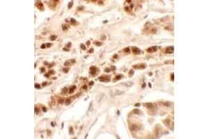 Immunohistochemistry (IHC) image for anti-Patched Domain Containing 2 (PTCHD2) (Middle Region) antibody (ABIN1031050)