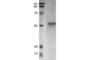 Image no. 1 for Cysteine-Rich Secretory Protein 3 (CRISP3) (Transcript Variant 2) protein (His tag) (ABIN2712559)