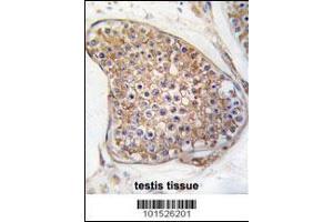 Image no. 3 for anti-TEK Tyrosine Kinase, Endothelial (TEK) (AA 758-789), (C-Term) antibody (ABIN392059)
