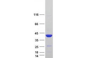 Image no. 1 for Prostaglandin Reductase 1 (PTGR1) (Transcript Variant 1) protein (Myc-DYKDDDDK Tag) (ABIN2729771)