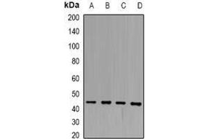Image no. 1 for anti-Squamous Cell Carcinoma Antigen 1 (SCCA1) (full length) antibody (ABIN6004268)