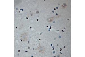 Image no. 1 for anti-SH3 and Multiple Ankyrin Repeat Domains 3 (SHANK3) (Internal Region) antibody (ABIN350831)