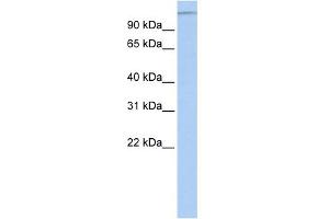 Image no. 1 for anti-Microtubule Associated Tumor Suppressor 1 (MTUS1) (Middle Region) antibody (ABIN2781855)