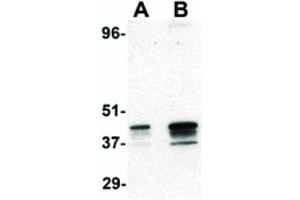 Image no. 3 for anti-Ribonucleotide Reductase M2 B (TP53 Inducible) (RRM2B) (N-Term) antibody (ABIN6656370)