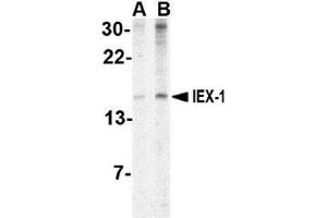 Image no. 2 for anti-Immediate Early Response 3 (IER3) (Center) antibody (ABIN499960)