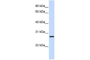 Image no. 1 for anti-TGFB-Induced Factor Homeobox 2-Like, X-Linked (TGIF2LX) (Middle Region) antibody (ABIN2775063)