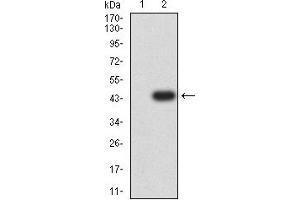 Image no. 3 for anti-Carcinoembryonic Antigen-Related Cell Adhesion Molecule 1 (Biliary Glycoprotein) (CEACAM1) (AA 65-201) antibody (ABIN5684132)