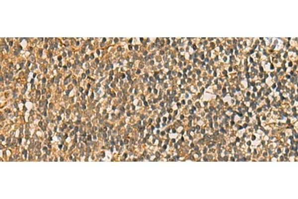 C17orf70 antibody