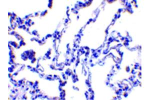 Image no. 2 for anti-Ribonucleotide Reductase M2 B (TP53 Inducible) (RRM2B) (N-Term) antibody (ABIN6656370)