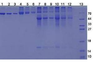 Image no. 3 for 25-Hydroxyvitamin D3 (HVD3) peptide (BSA) (ABIN5665930)