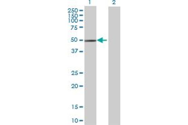 anti-Tetratricopeptide Repeat Domain 4 (TTC4) (AA 1-387) antibody