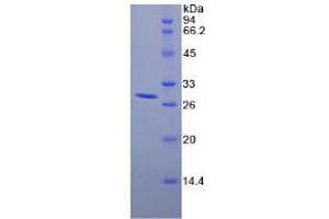 Image no. 1 for DEAD (Asp-Glu-Ala-Asp) Box Polypeptide 58 (DDX58) protein (ABIN3011473)