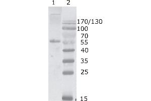 Image no. 1 for anti-Human Immunodeficiency Virus 1 Capsid (HIV-1 p24) (AA 80-90) antibody (ABIN400483)