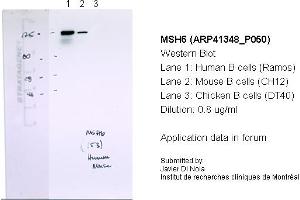 Image no. 2 for anti-MutS Homolog 6 (E. Coli) (MSH6) (N-Term) antibody (ABIN2776759)