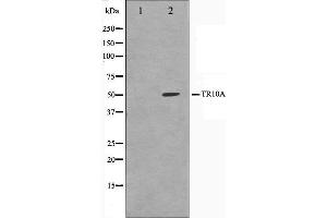 Image no. 2 for anti-Drought-Repressed 4 Protein (DR4) antibody (ABIN6265699)