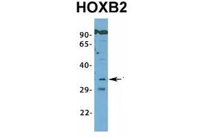 Image no. 4 for anti-Homeobox B2 (HOXB2) (N-Term) antibody (ABIN2776384)