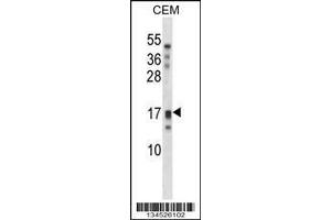 Image no. 2 for anti-Kallikrein-Related Peptidase 15 (KLK15) (AA 79-106), (Center) antibody (ABIN2488895)