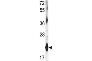 Image no. 5 for anti-Dihydrofolate Reductase (DHFR) (AA 135-164) antibody (ABIN3030729)