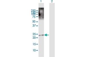 Image no. 1 for anti-Tripartite Motif Family-Like 1 (TRIML1) (AA 1-192) antibody (ABIN949946)