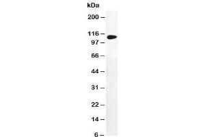 Image no. 1 for anti-Dihydropyrimidine Dehydrogenase (DPYD) (AA 33-52) antibody (ABIN3030731)