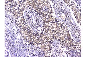 Image no. 2 for anti-T-Complex 1 (TCP1) (AA 515-551), (C-Term) antibody (ABIN5693078)
