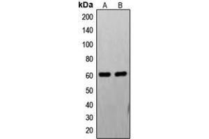 Image no. 2 for anti-Fas-Activated serine/threonine Kinase (FASTK) (Center) antibody (ABIN2706142)