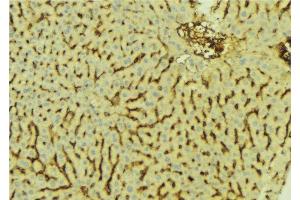 ABIN6276627 at 1/100 staining Mouse liver tissue by IHC-P.
