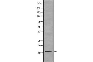 Image no. 1 for anti-Transition Protein 2 (During Histone To Protamine Replacement) (TNP2) (Internal Region) antibody (ABIN6265663)
