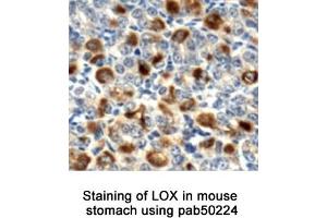Image no. 1 for anti-Lysyl Oxidase (LOX) (AA 200-300), (Internal Region) antibody (ABIN363533)