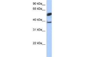 Image no. 1 for anti-Speckle-Type POZ Protein-Like (SPOPL) (N-Term) antibody (ABIN2784140)