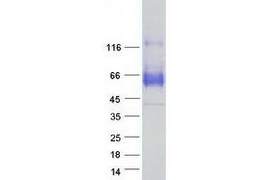 Image no. 1 for Synaptotagmin I (SYT1) (Transcript Variant 1) protein (Myc-DYKDDDDK Tag) (ABIN2733065)