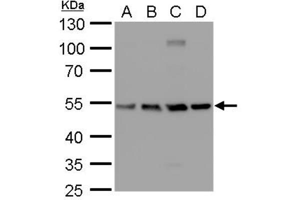 TUBB2A antibody  (Center)