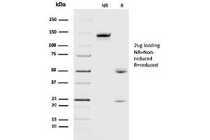 Image no. 5 for anti-Crystallin, alpha B (CRYAB) antibody (ABIN6939187)