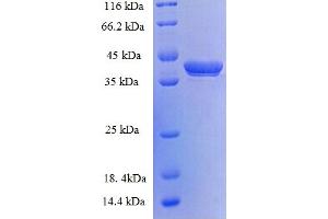 Image no. 1 for G Antigen 5 (GAGE5) (AA 1-117), (full length) protein (GST tag) (ABIN5709551)