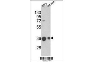 Image no. 3 for anti-Malate Dehydrogenase 2, NAD (Mitochondrial) (MDH2) (AA 86-115) antibody (ABIN389448)