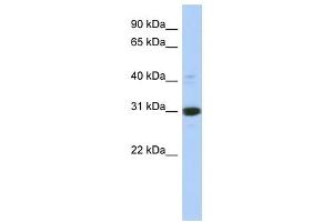 Image no. 1 for anti-Inositol(myo)-1(or 4)-Monophosphatase 1 (IMPA1) (Middle Region) antibody (ABIN632122)