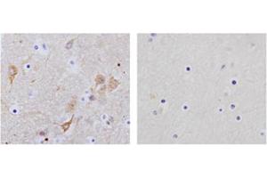 Image no. 2 for anti-Enolase 2 (Gamma, Neuronal) (ENO2) (C-Term) antibody (ABIN1574104)