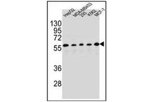 Image no. 2 for anti-Paired Box 1 (PAX1) (AA 356-385), (C-Term) antibody (ABIN954006)