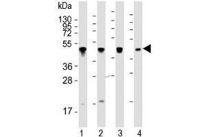 Image no. 12 for anti-Keratin 18 (KRT18) (AA 401-430) antibody (ABIN3031537)