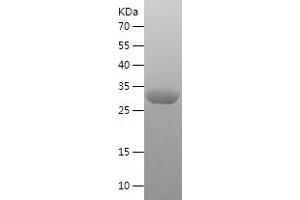 S100A12 Protein (AA 2-92) (His-IF2DI Tag)