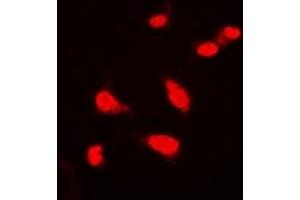 Immunofluorescent analysis of BAP1 staining in Hela cells.