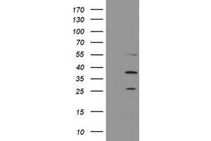 Image no. 2 for anti-Proteasome (Prosome, Macropain) Subunit, beta Type, 7 (PSMB7) (AA 58-277) antibody (ABIN2729939)