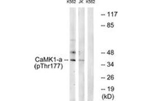 Image no. 3 for anti-Calcium/calmodulin-Dependent Protein Kinase I (CAMK1) (AA 143-192), (pThr177) antibody (ABIN1531530)