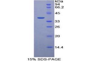 Image no. 1 for Pepsinogen C (PGC) (AA 61-388) protein (His tag) (ABIN1080479)