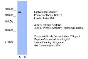 Image no. 9 for anti-SRY (Sex Determining Region Y)-Box 10 (SOX10) (Middle Region) antibody (ABIN2777864)