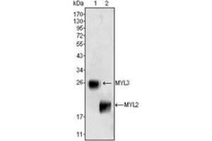 Image no. 1 for anti-Myosin, Light Chain 3 (MYL3) antibody (ABIN1108351)