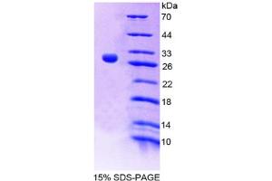 Image no. 1 for Interleukin 9 Receptor (IL9R) (AA 47-257) protein (T7 tag,His tag) (ABIN6237933)