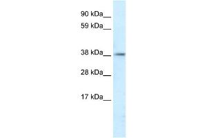 Image no. 2 for anti-Proteasome (Prosome, Macropain) 26S Subunit, Non-ATPase, 11 (PSMD11) (C-Term) antibody (ABIN2777703)